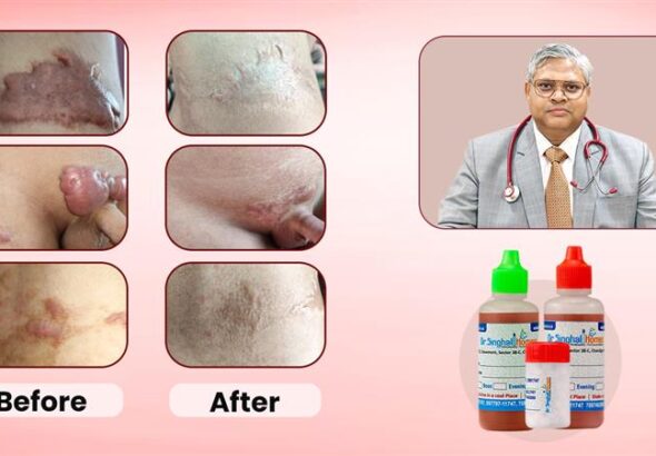 Dr. Vikas Singhal