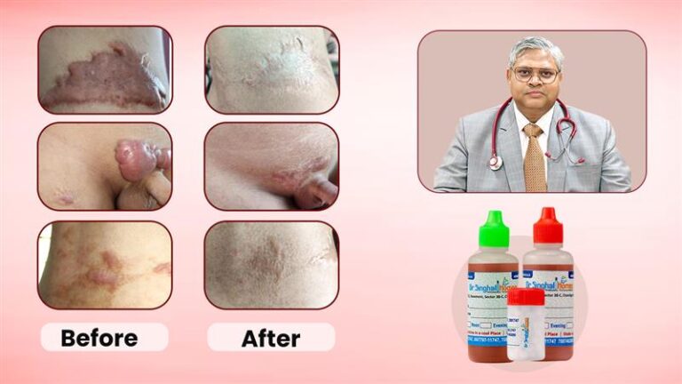 Dr. Vikas Singhal