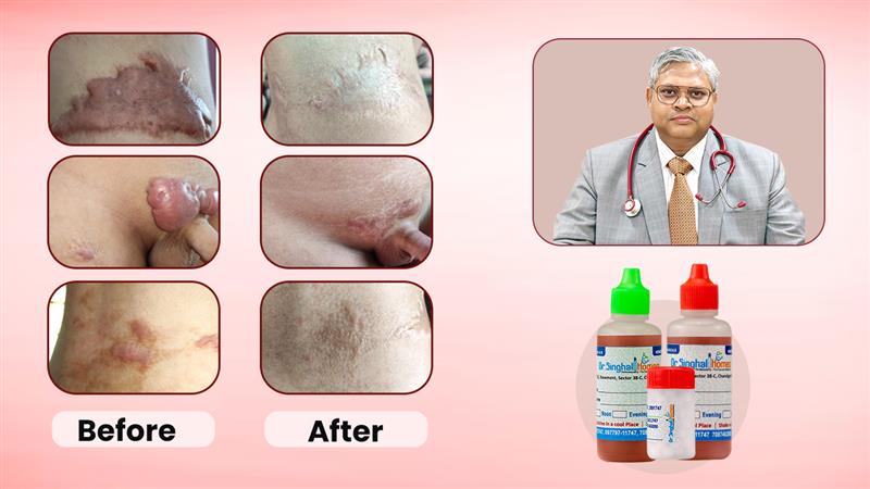 Dr. Vikas Singhal